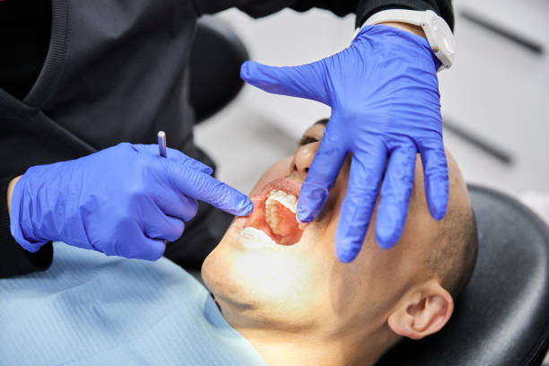 Best Emergency Wisdom Tooth Extraction in Mcleansville, NC